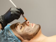 Czym jest laserowy peeling węglowy i dlaczego warto z niego skorzystać? Laserowy peeling węglowy