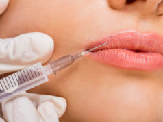 Jak powiększyć usta i nadal wyglądać naturalnie? kwas hialuronowy