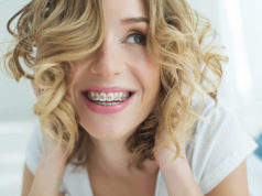 Sposoby prostowania uzębienia i rodzaje aparatów na zęby uśmiechnięta kobieta z aparatem na zębach