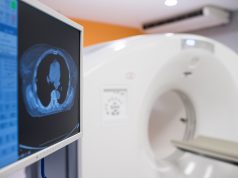 Tomografia komputerowa – na czym polega oraz na co pozwala? Tomografia komputerowa badanie