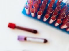 Badania krwi – wskazania i przeciwwskazania badania krwi