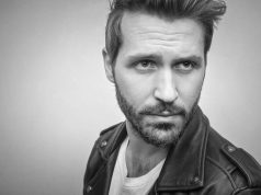 Dla kogo transplantacja włosów – Turcja zaprasza transplantacja włosów